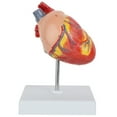 thumbnail image 5 of Axis Scientific 2-Part Life-Size Canine Heart Anatomy Model - Detailed Canine Heart Anatomy Model for Veterinarians, Teachers, Students -Includes Study Guide - Durable and Realistic, 5 of 10
