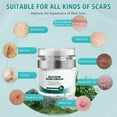 thumbnail image 7 of Silicone Scar Cream Scar Gel, Advanced Scar Cream for Surgical Scars, C-Section, Injury, Stretch Marks, Acne, Burns, Keloids, Old & New Scars, 1.85 Oz (55g), 7 of 7