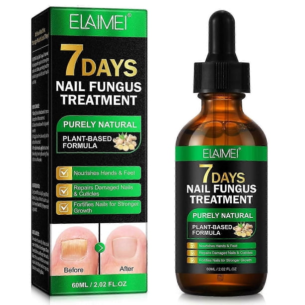 1/2/3PCS Nail Fungus Treatment, Ginger Nail Fungus Treatment, Toenail Cuticle Care Oil Care, Fungal Nail Treatment, 7 Days Nail Fungus Treatment