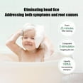 AYFFDIYI Shampoo to Get Rid of Lice Children Head Lice Removal Shampoo Treatme Market F3H2