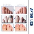 thumbnail image 2 of Tratamiento de uñas AFeng 10ml, 2 of 5