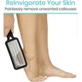 thumbnail image 3 of Vive Foot File - Callus Remover Pedicure Tool for Men & Women Foot Care - Dead Skin Scrub Shaver & Rough Patch Eliminator Remover (Single), 3 of 5