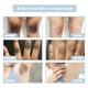 thumbnail image 5 of Cremas corporales de 50ml, acantosis Nigricans portátil, manchas oscuras para todo el cuidado de la piel Sywqhk Cuidado Belleza, 5 of 8