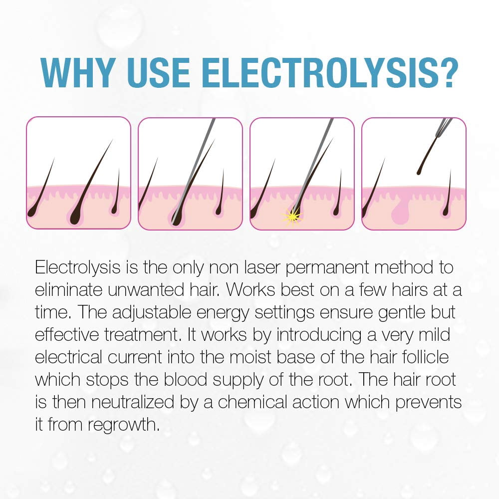 Clean and Easy Non-Laser Personal Electrolysis Facial Hair Removal Device for Flawless Face & Body