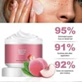 thumbnail image 5 of Gentle Depilatory Cream For Sensitive Skin Fast Gentle Effective Hair Removal Cream for All Skin Types, 5 of 5