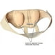 thumbnail image 2 of Cinturón para hernia inguinal para hombres, alivio del dolor de hernia posoperatoria, faja ortopédica para hernia inguinal doble o simple, comodidad superior y presión ajustable, 2 fajas extraíbles, 2 of 5