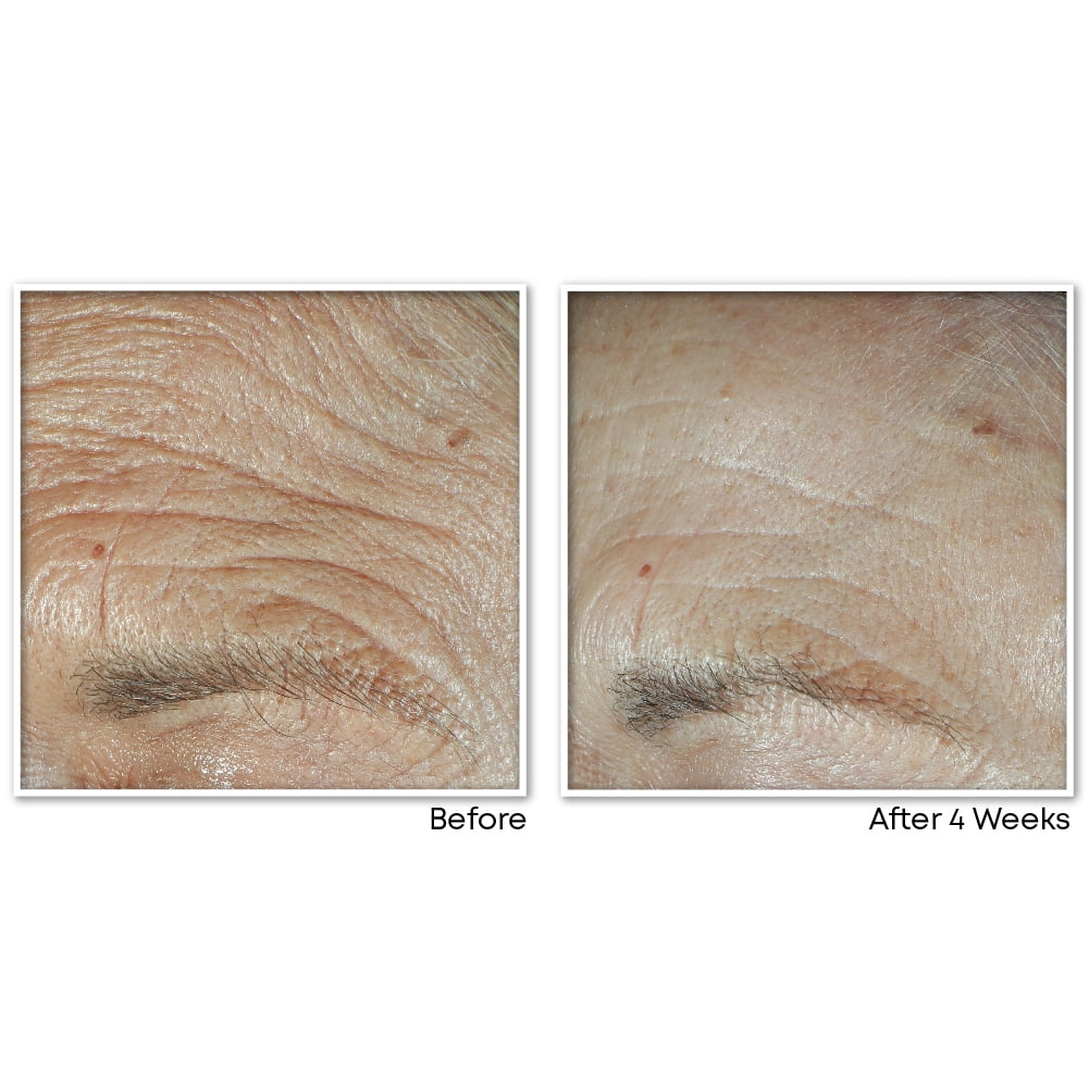 roc multi correxion crepe repair