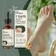 thumbnail image 2 of 7 Days Teas Tree Ginger Nailfungus Treatments, Nourishing Strengthening Nails Liquid for Healthier Growth, for Finger Toe Nails, 2 of 5