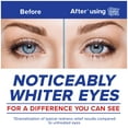 thumbnail image 5 of 3 Pack - Clear Eyes Redness Relief Eye Drops, Soothes & Moisturizes - 0.5 fl oz (15ml), 5 of 6