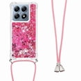thumbnail image 1 of Funda FOXDOCK para Xiaomi 14T con Cuerda Ajustable, Brillo Líquido, Protección Antigolpes y Lente – Ideal para Regalo, 1 of 6