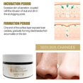 thumbnail image 5 of Masque au Ginseng Transitionnel Masque Pelable Tête Noire au Ginseng 100g Fff, 5 of 5