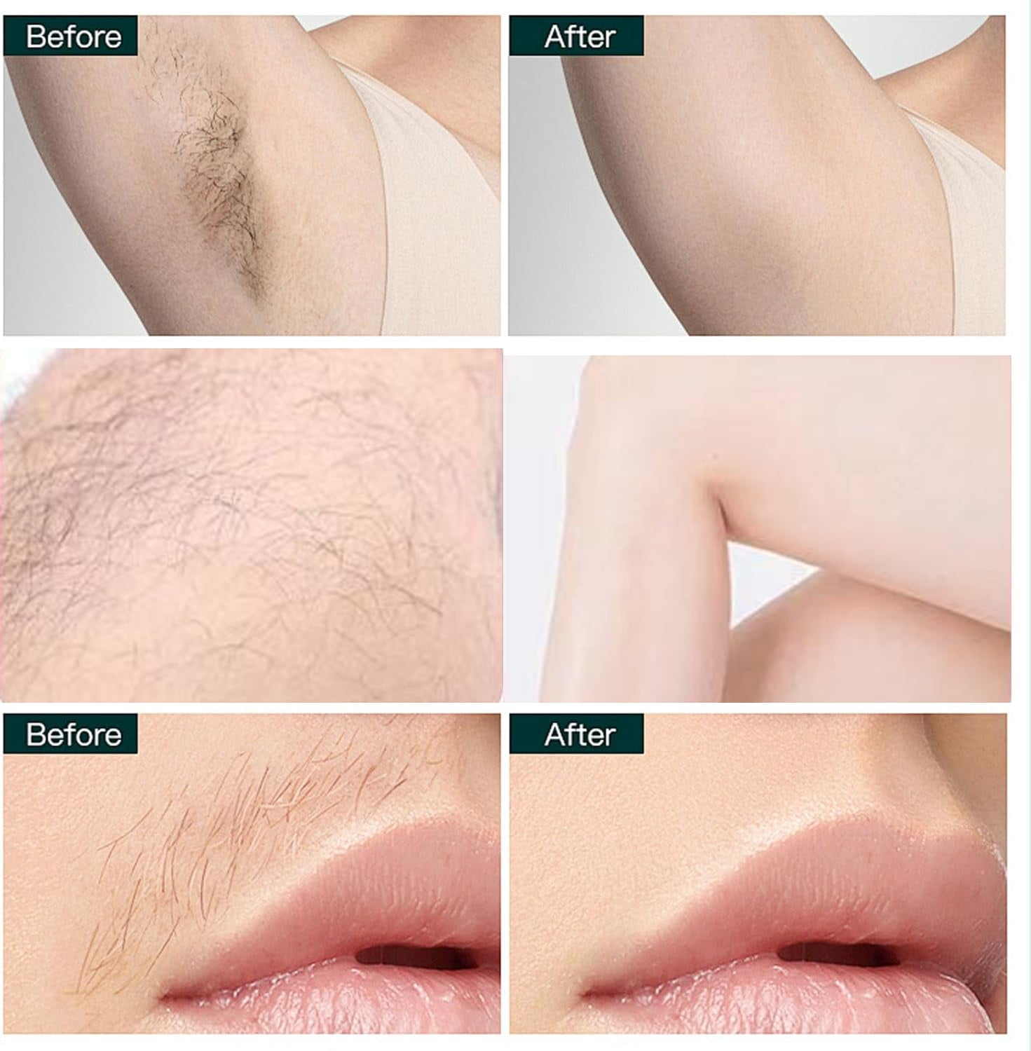 Facial Hair Remover, New Gentle Micro-Trimming with Led Light, 2026 Painless Electric Face Razor for Coarse Hair