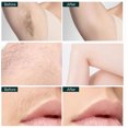 thumbnail image 4 of Facial Hair Remover, New Gentle Micro-Trimming with Led Light, 2026 Painless Electric Face Razor for Coarse Hair, 4 of 6