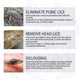 thumbnail image 5 of Head Lice Removal Spray Anti-itch Anti-pruritus Antibacterial Remove Mites Fleas Tick Louse Eggs Pubic Lice Hair Care, 5 of 5