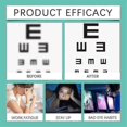 thumbnail image 2 of Eye-Vision Roller 3pcs Relieves Dry and Tired Eyes for Adults, 2 of 4
