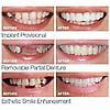 thumbnail image 2 of Smile Snap On False Teeth Upper Lower Dental Veneers Dentures Tooth Cover Set _fs, 2 of 5