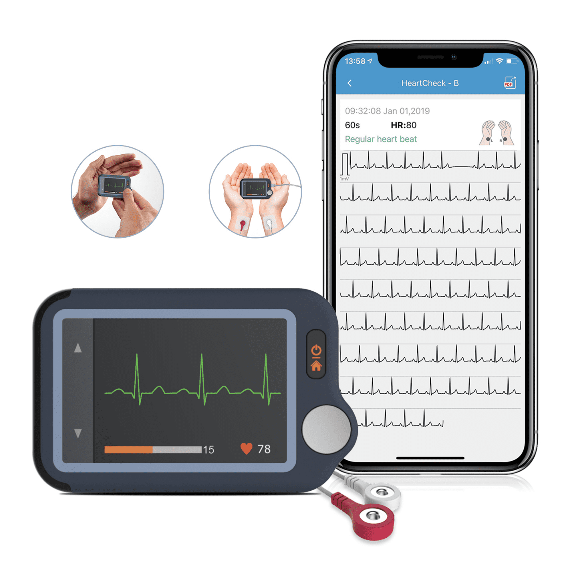 Portable Ecg Monitor Canada