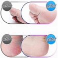 thumbnail image 3 of Vett [4 Pack] Extra Coarse Replacement Rollers Compatible For Emjoi Micro Pedi Replacement Rollers, 3 of 5