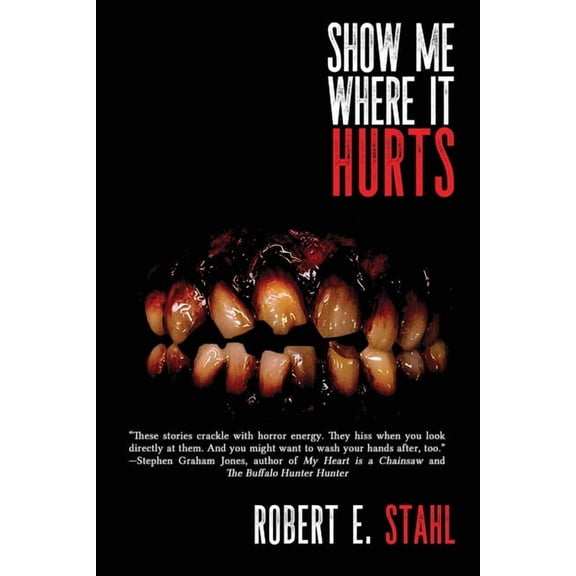 Show Me Where It Hurts, (Paperback)