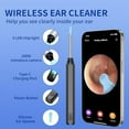 Ear Wax Removal Tool Ear Camera with 360Â° Visual Ear Cleaning Kit