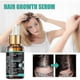 thumbnail image 2 of Jaysuing Dense Hair Essence Repair And Moisturize Dry Hair To Prevent Dense Hair, 2 of 5