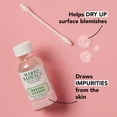 thumbnail image 4 of Loción secante Mario Badescu para tratamiento de manchas, 30 ml, 4 of 9
