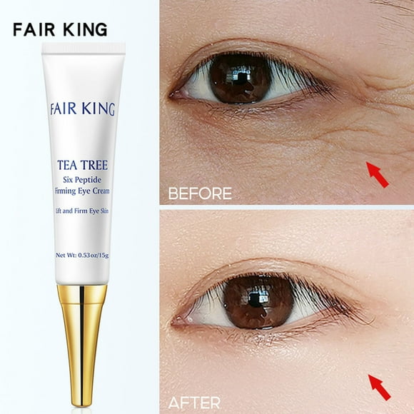 Up to 50% Off Naittoop Eye Serum, Power Firming Eye Cream, Eye Cream for Dark Circles and Swelling, Anti-Ageing Rapide Reduction Eye Cream for All Skin Types 15g