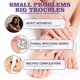 thumbnail image 3 of Jaysuing Gray Nail Repair Spray Hand And Foot Nail Soft Nail Yellow Endogenous Nail Thickening Cleaning Care - 100ml, 3 of 5