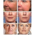 thumbnail image 2 of Retinol Instant Wrinkles Removal Cream 5 Seconds Lifting Firming Anti-aging Improve Puffiness Fade Fine Lines Face Care Products, 2 of 5