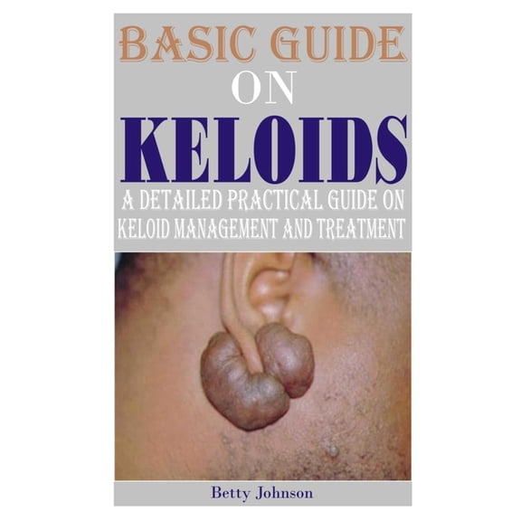 Basic Guide on Keloids: A detailed practical guide on keloid management and treatment (Paperback)