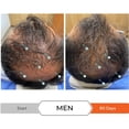 thumbnail image 3 of Shampoo Anticaída Y Estimulante Folicular DS Laboratories REVITA, 3 of 4