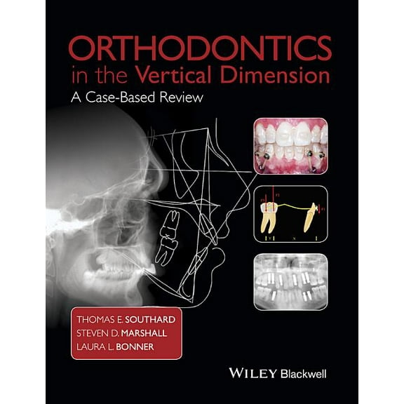 Orthodontics in the Vertical Dimension: A Case-Based Review, (Hardcover)