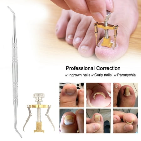 Pedicure Tool,Fosa 2Pcs/Set Foot Care Toenails Lifter Ingrown Nail Paronychia Correction File Pedicure Cleaner,Nail