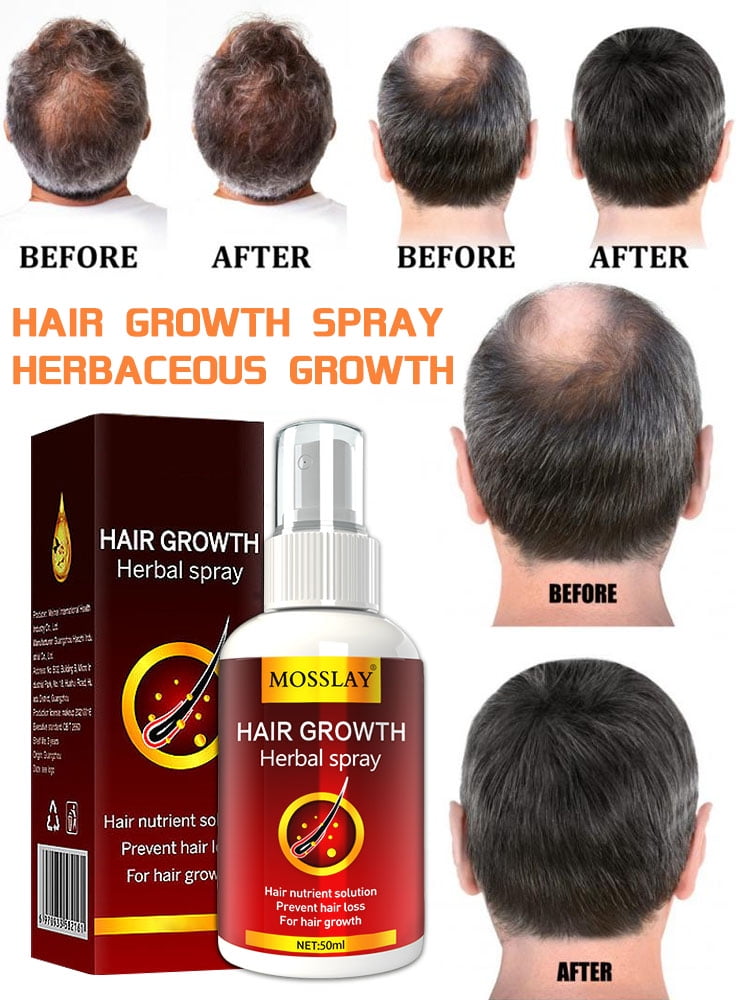 Hair Growth Serum Spray Fast Hair Growth Liquid Treatment Scalp Hair  Follicle Anti Hair Loss Natural Beauty Health Hair Care 