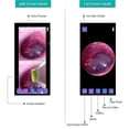 thumbnail image 2 of Wireless Otoscope Ear Camera Dual View 3.9mm HD Endoscope with 6 LED Lights for iOS Android Ear Cleaning Inspection Tool, 2 of 7