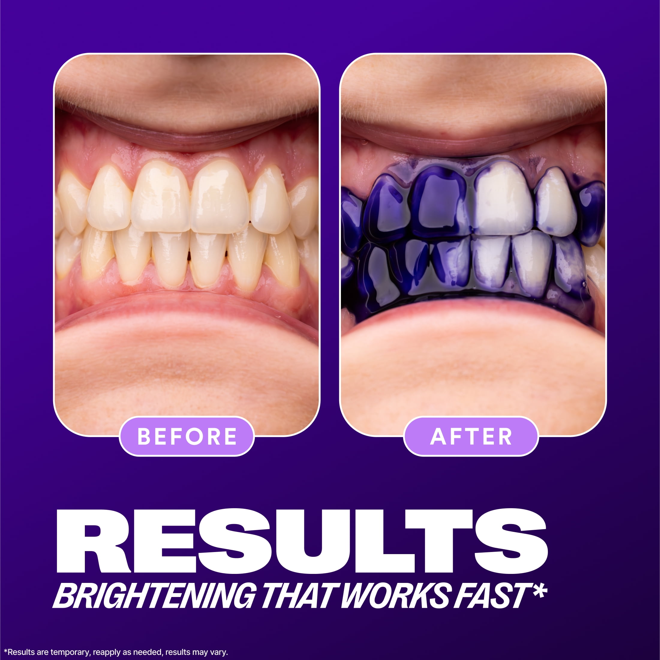 Hismile V34 Colour Corrector, Purple Toothpaste, Colour Correcting Serum, Purple Serum