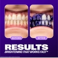 thumbnail image 3 of Hismile V34 Colour Corrector Serum, Teeth Whitening, 3 of 7