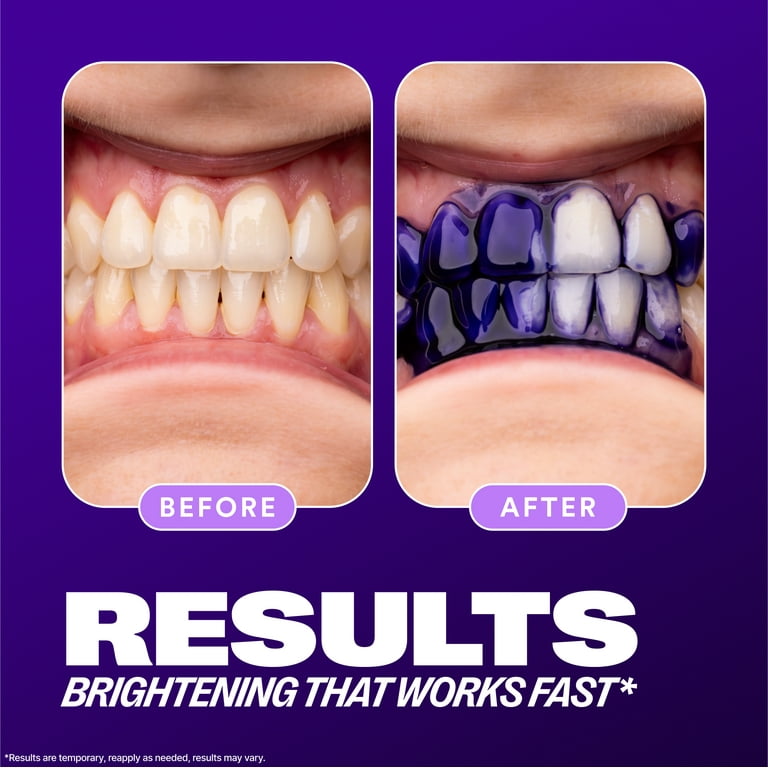 smile☆ HiSmile V34 Colour Corrector Serum, Teeth Whitening