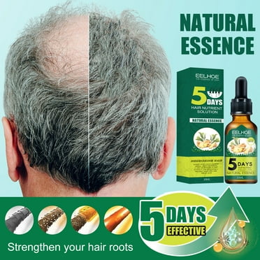 BGZLEU Ginger Oil for Hair Growth,Hair Growth Serum,Biotin Hair Growth Oil,Hair Growth Ginger Serum for Men and Women,Hair Growth Treatment,Hair Loss Treatment,Promotes Thicker Growth Hair