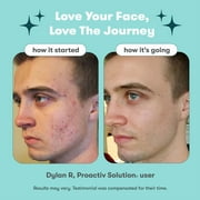 Proactiv Solution 3-Step Mini Acne Treatment System for Oily and Combination Skin