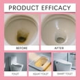 thumbnail image 6 of Toilet Bowl Cleaners, 12-Pack Daily Cleaning Tablets, Stain Remover and Odor Neutralizer for a Fresh, Clean Bowl, 6 of 8