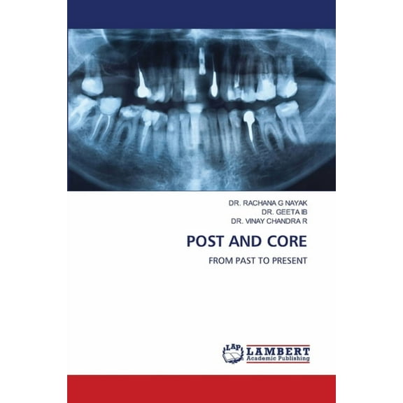 Post and Core, (Paperback)