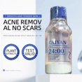 thumbnail image 4 of ICE LERSKIN Precision Say Goodbye To Stubborn And Say To Smooth Skin Fade Marks Repair Skin Barrier Gently For Skin 30ml|White, 4 of 8