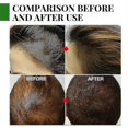thumbnail image 1 of Rosemary Oil Nourishes, Repairs, Improves Split Ends, Cares Compatible With Hair, Eliminates Itchy And Dry S, 1 of 2