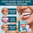 thumbnail image 4 of Adjustable Snap-On Veneers for Men Women - Temporary Fake Teeth Instant Denture Cover for Perfect Smile, Comfort Fit, 4 of 5