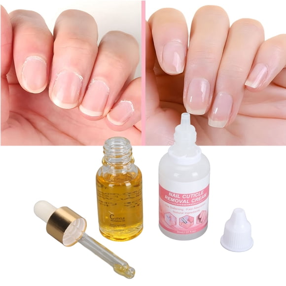 Kit Removedor De Cutículas, Kit Removedor De Cutículas Para Uñas Que Promueve El Crecimiento De Las Uñas Y Nutre Para Uso Doméstico