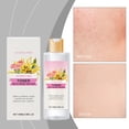 thumbnail image 3 of Tónico de granada 100ml | Tónico facial hidratante y humectante para iluminar la piel, aclarar las manchas oscuras, revitalizar la tez apagada | Cuidado de la piel blanqueadora para todo tipo de, 3 of 7