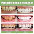 thumbnail image 2 of Ampoule Toothpaste, Ampoule Tooth Serum, Ampoule Essen, 2 of 5