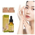 thumbnail image 1 of Essential oil Oil Hand Fine Finger Firming Oil Delicate Firming Aging Massage Oil 30ml, 1 of 9