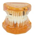 thumbnail image 1 of Implant Model, Pathological Anatomy Tooth Education, Reconstruction On Implant For  Schools Discussion Of Treatment, 1 of 8